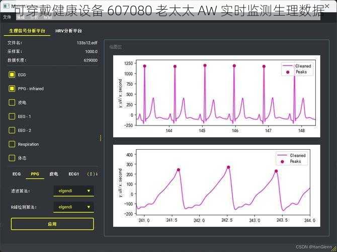 可穿戴健康设备 607080 老太太 AW 实时监测生理数据